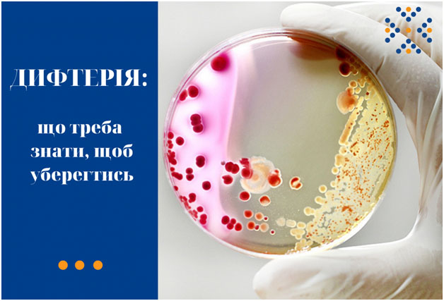 ЯК ЗАХИСТИТИСЯ ВІД ДИФТЕРІЇ ТА ПРАВЦЯ — ПОКРОКОВА ІНСТРУКЦІЯ ДЛЯ ДІТЕЙ І ДОРОСЛИХ
