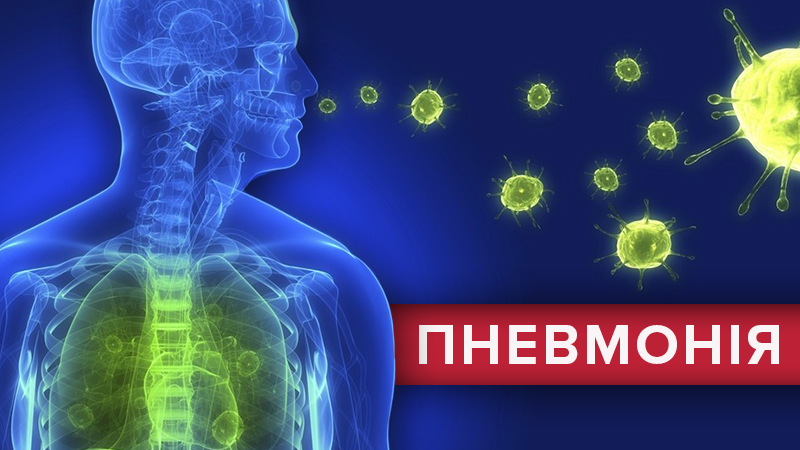 Симптоми пневмонії / запалення легень