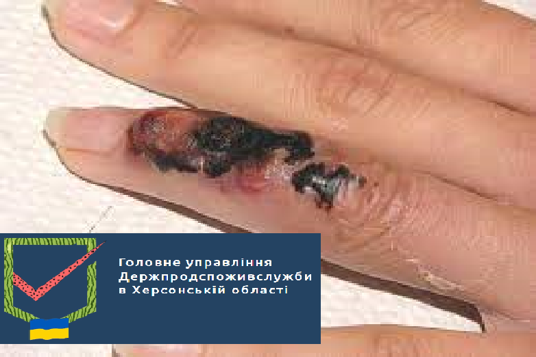 Головне управління Держпродспоживслужби в Херсонські області надає інформацію щодо можливих ускладнень епізоотичної ситуації стосовно місць захоронення сибіркових поховань