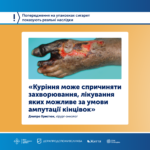 Куріння викликає гангрену та може призвести до ампутації