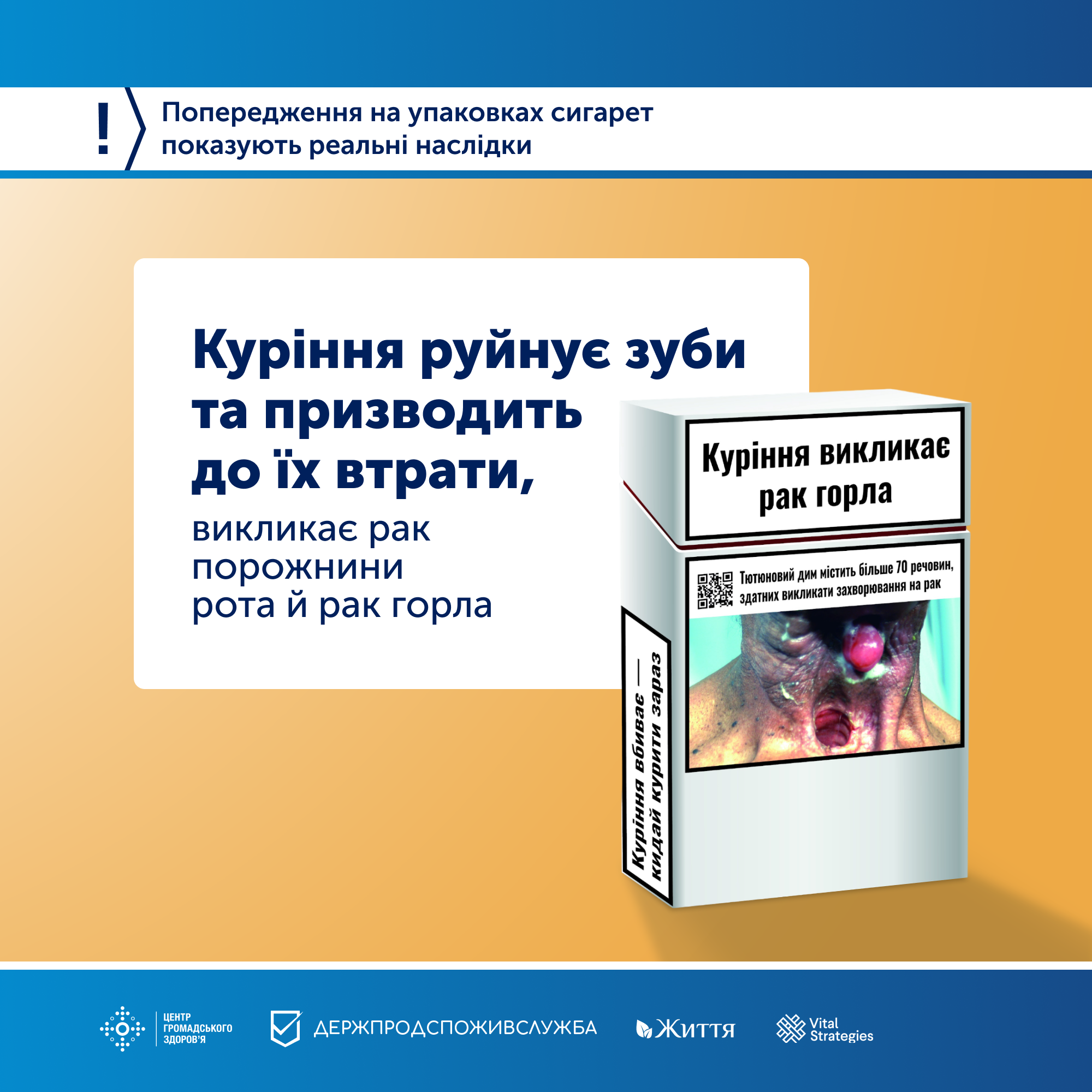 Куріння руйнує зуби та призводить до їх втрати, викликає рак порожнини рота, рак горла