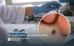 Обережно, кліщі: що треба знати про хворобу Лайма
