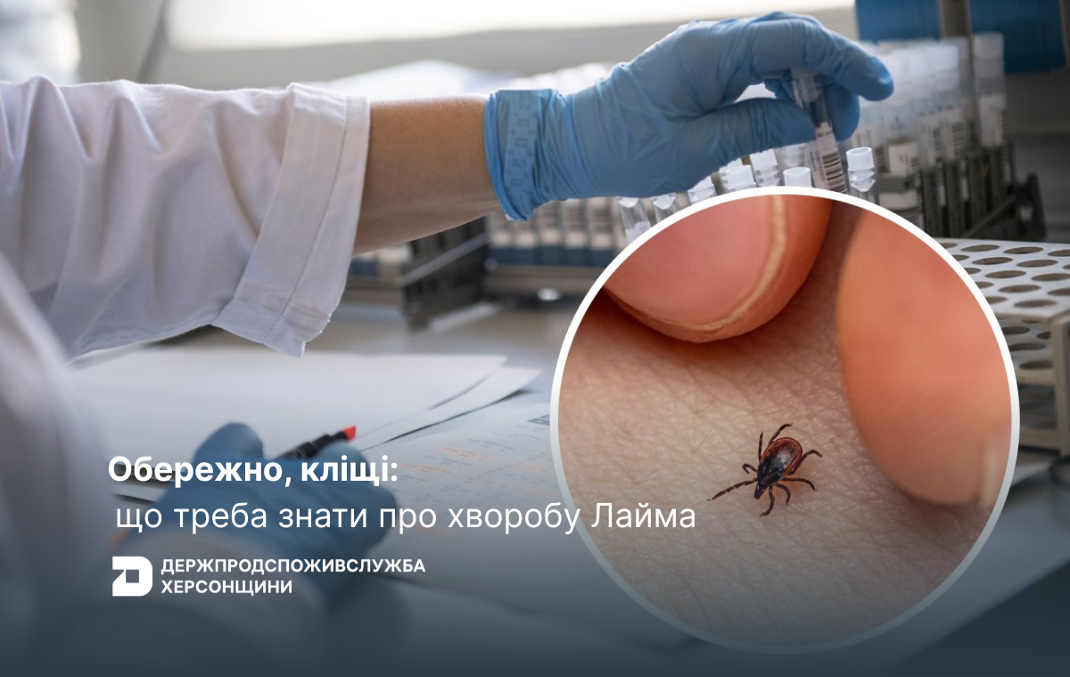 Обережно, кліщі: що треба знати про хворобу Лайма