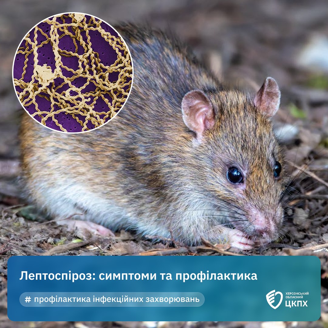 Лептоспіроз: симптоми та профілактика
